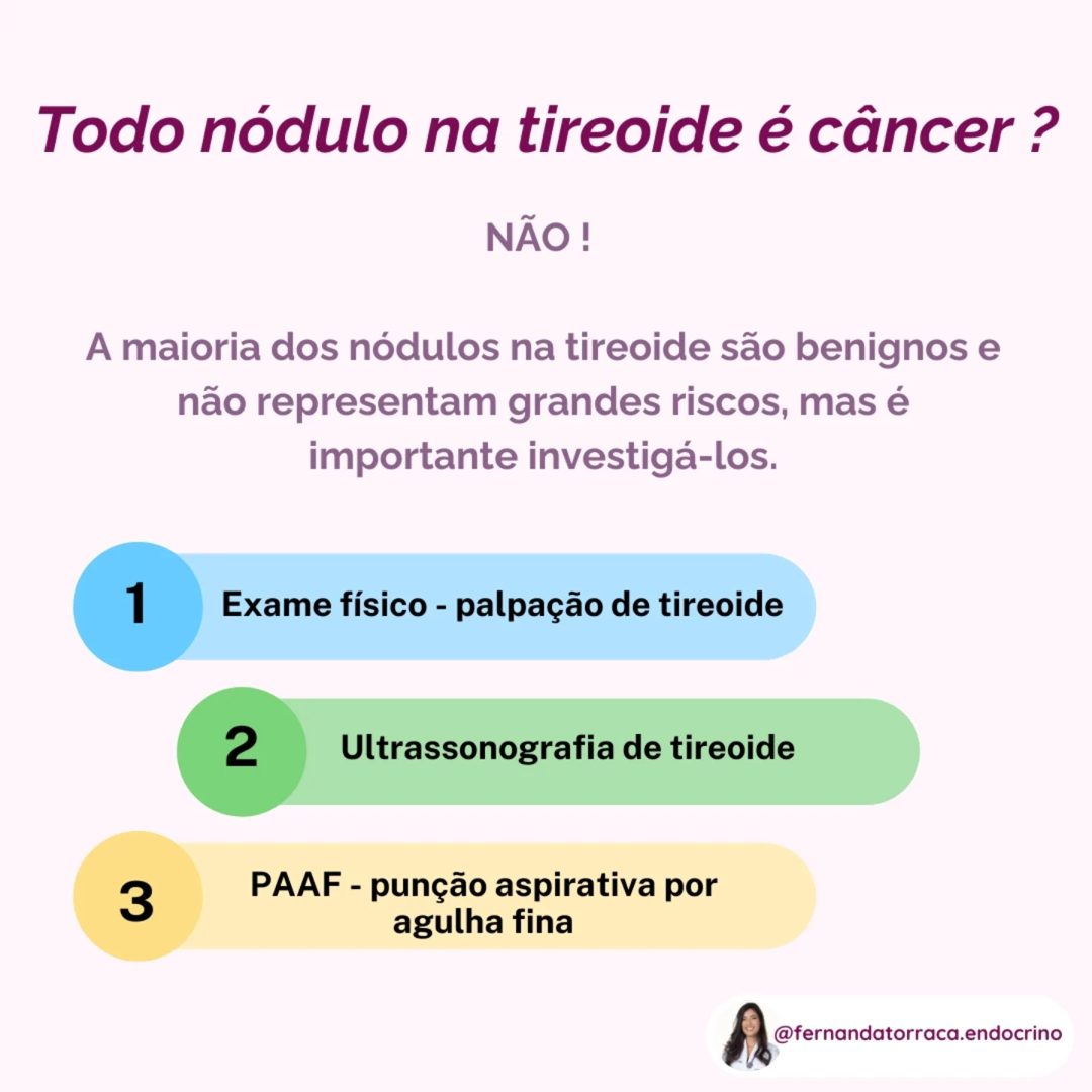 Todo nódulo na tireoide é câncer? (imagem 2 de 2)